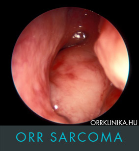 ORR sarcoma